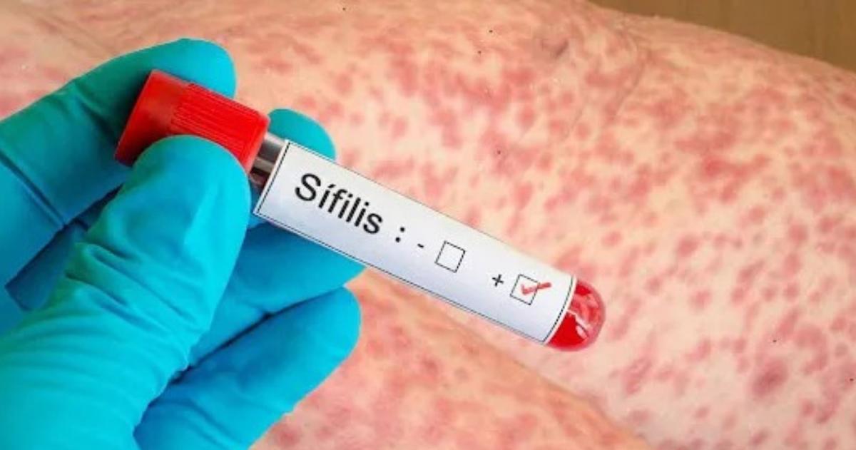 Preocupación sanitaria en un contexto nacional de crecimiento récord