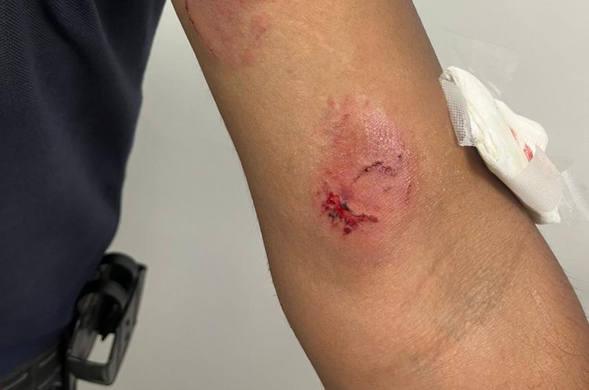 Un policía fue mordido en un brazo