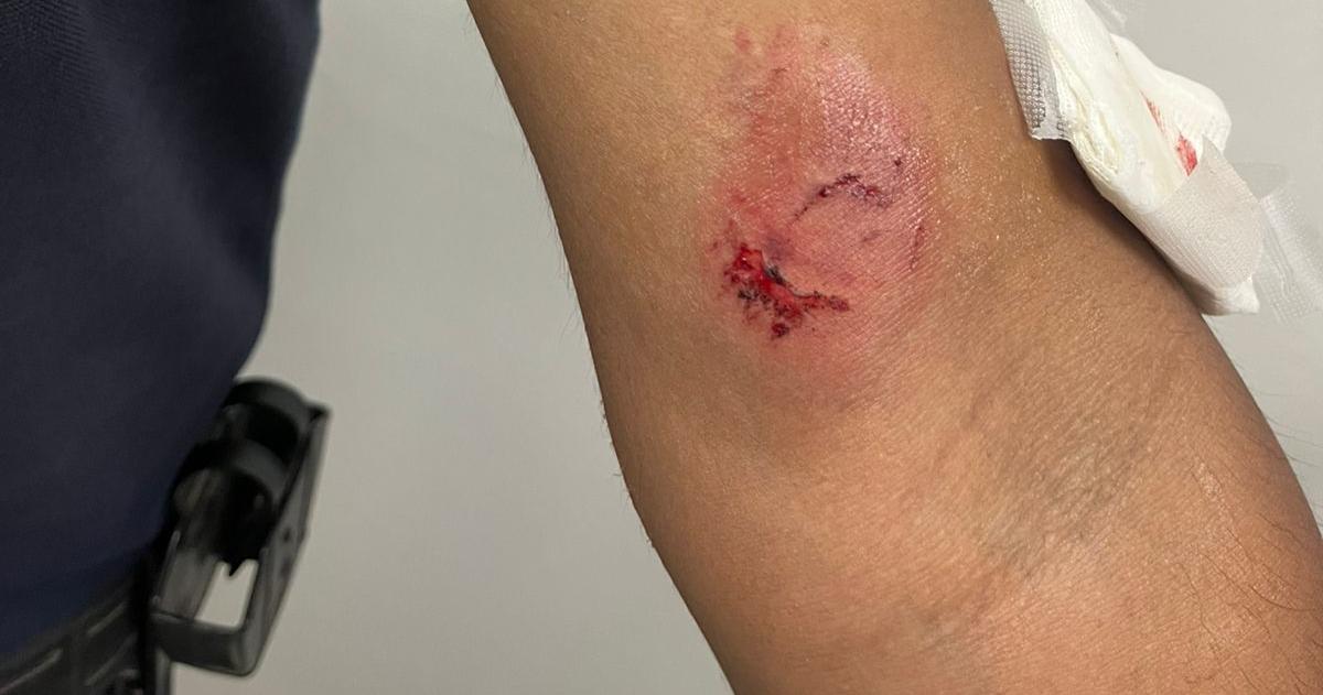 Un policía fue mordido en un brazo