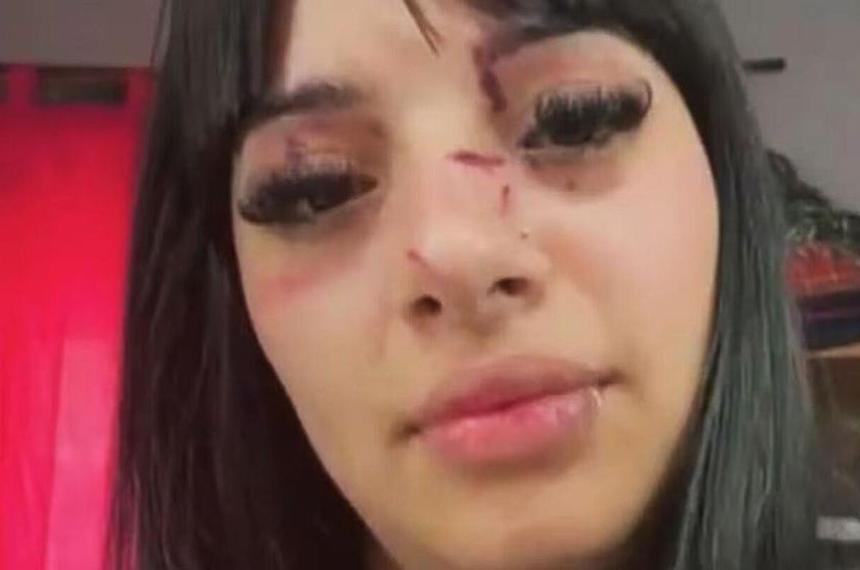Una joven denuncioacute una violenta agresioacuten a la salida de un boliche tras ser reconocida por sus videos de TikTok