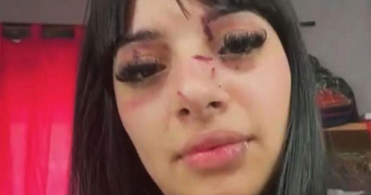 Una joven denuncioacute una violenta agresioacuten a la salida de un boliche tras ser reconocida por sus videos de TikTok