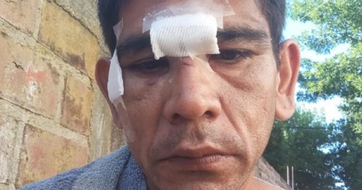 La víctima fue trasladada de urgencia al Hospital Gobernador Centeno de General Pico