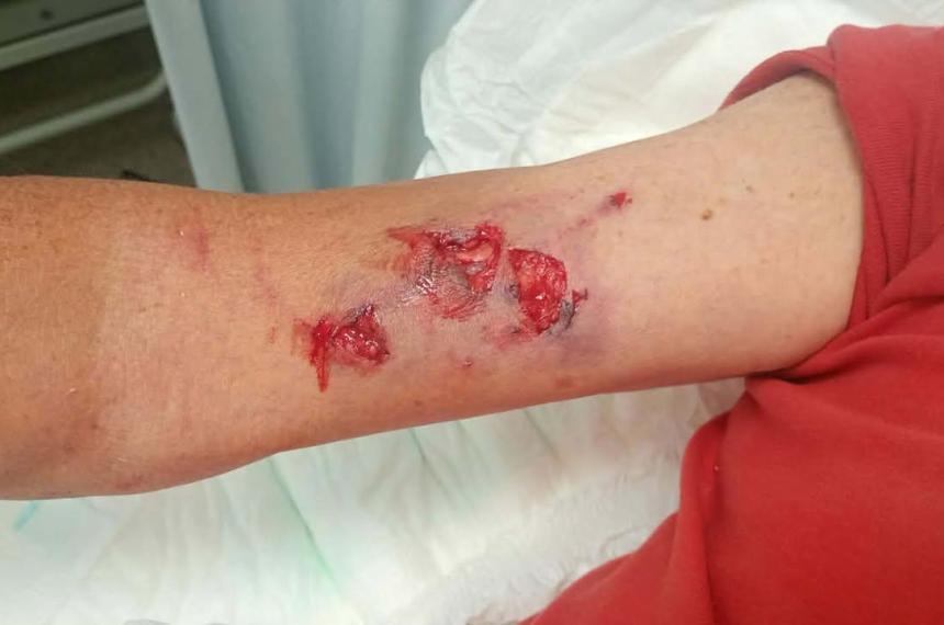 Lo atacoacute un perro y le tuvieron que dar siete puntos