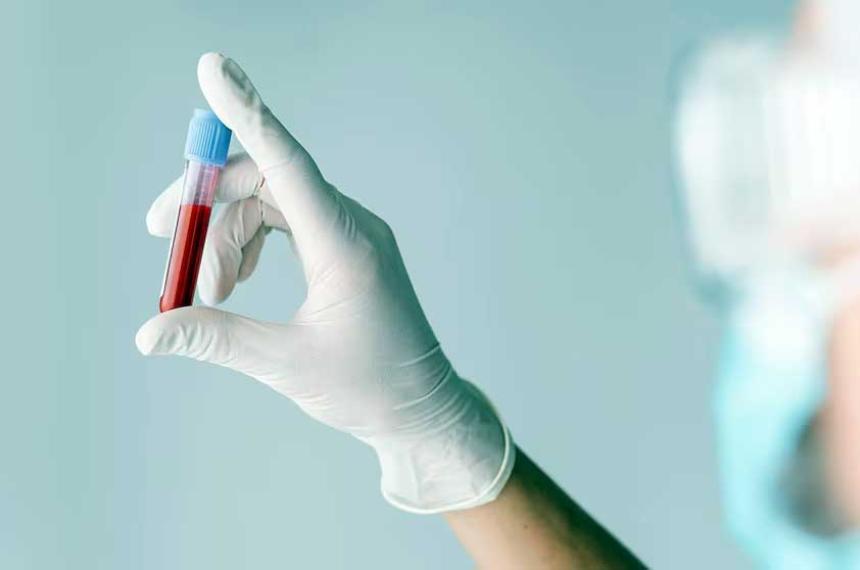 La terapia BE-CAR7 ofrece una nueva esperanza para pacientes con leucemia linfoblstica aguda de células T resistente a tratamientos convencionales