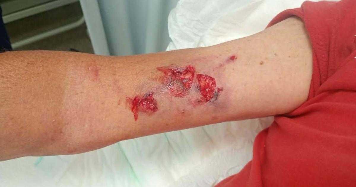 Lo atacoacute un perro y le tuvieron que dar siete puntos