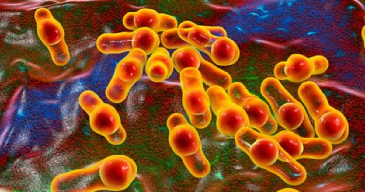 Botulismo- alerta por un caso sospechoso