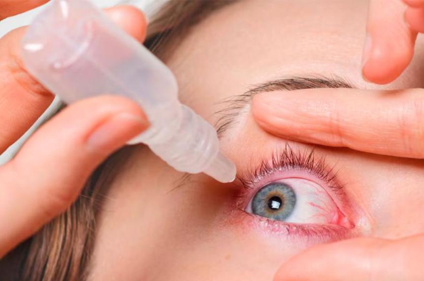 Ojos secos en verano- seis medidas simples para prevenir el siacutendrome