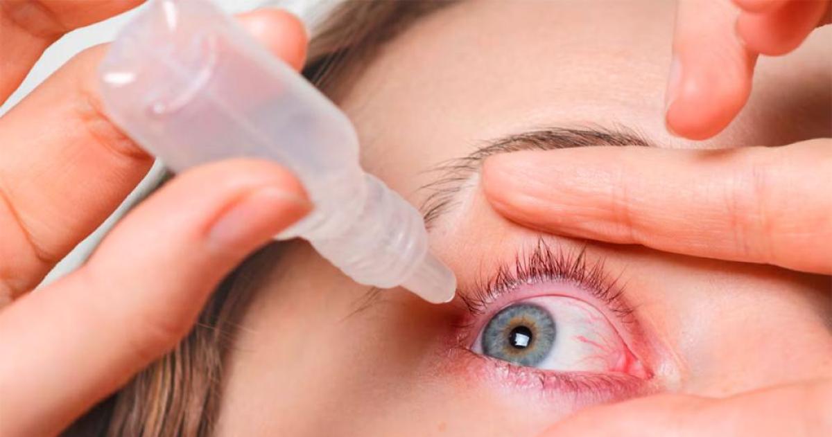 Ojos secos en verano- seis medidas simples para prevenir el siacutendrome