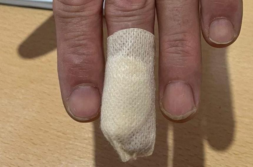 Un repartidor de Mercado Libre fue mordido por un Pitbull en Toay