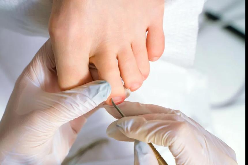 Ciertos signos pueden requerir de atención podológica urgente en personas con diabetes u otras enfermedades crónicas