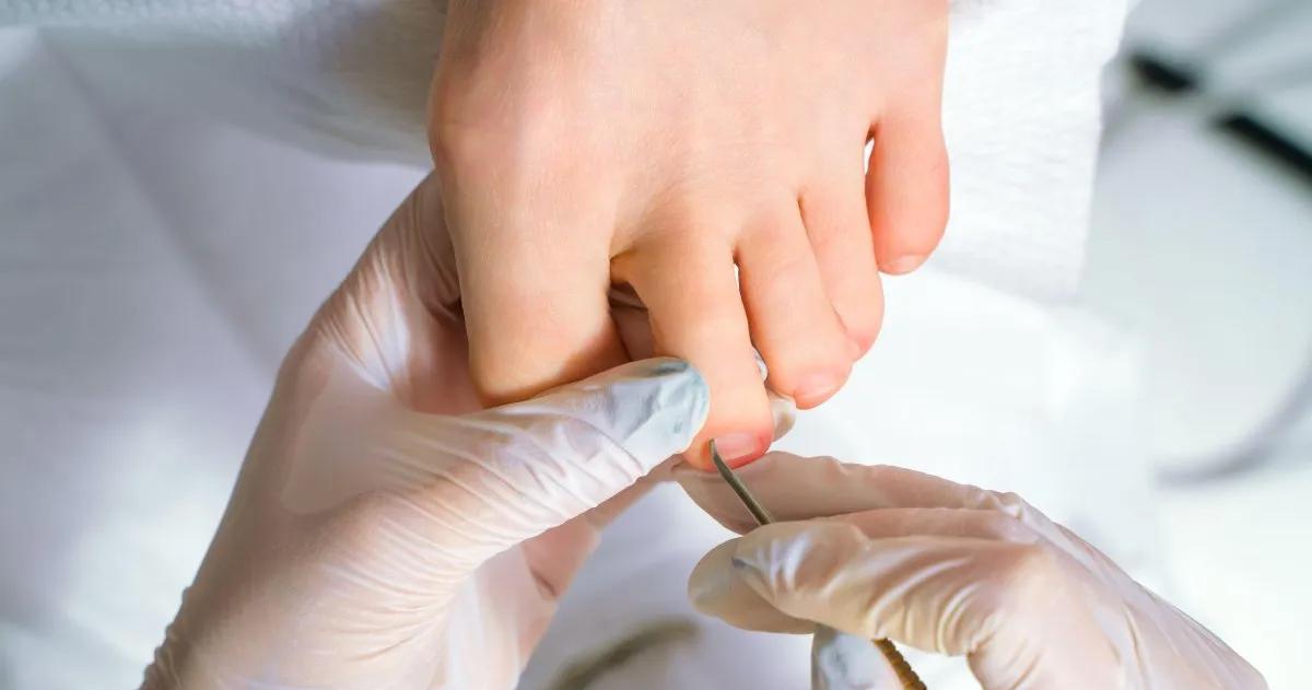 Ciertos signos pueden requerir de atención podológica urgente en personas con diabetes u otras enfermedades crónicas