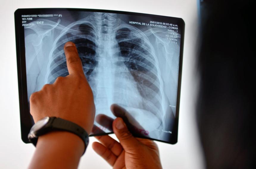 La tasa nacional trepó a 346 cada 100 mil habitantes