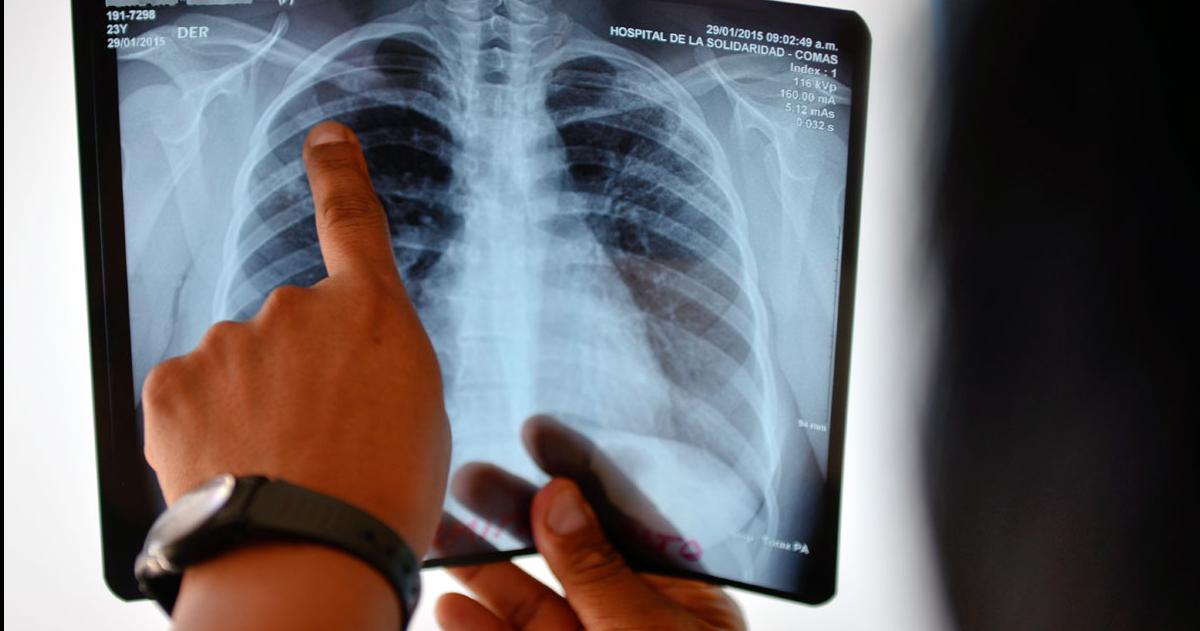 La tasa nacional trepó a 346 cada 100 mil habitantes