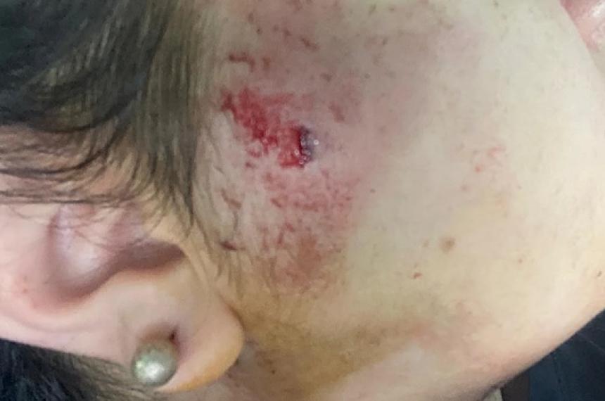 La joven sufrió una herida en la cabeza
