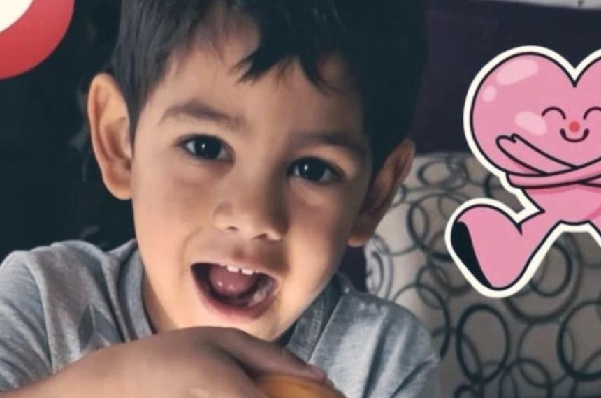 Angel el nene de 4 años tenía lesiones en la cabeza y marcas de vieja data