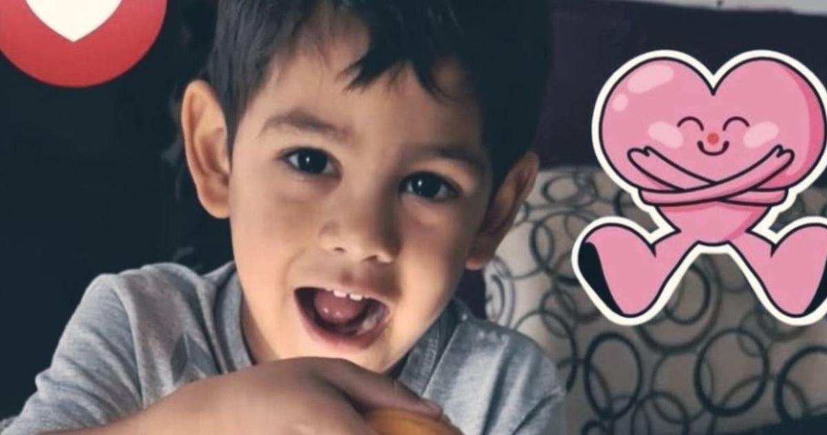Angel el nene de 4 años tenía lesiones en la cabeza y marcas de vieja data