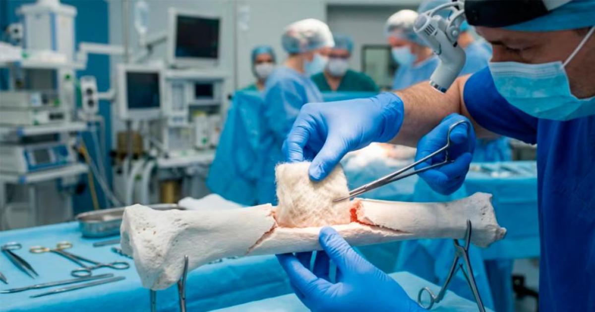 La lana clave en un avance científico que promete regenerar huesos