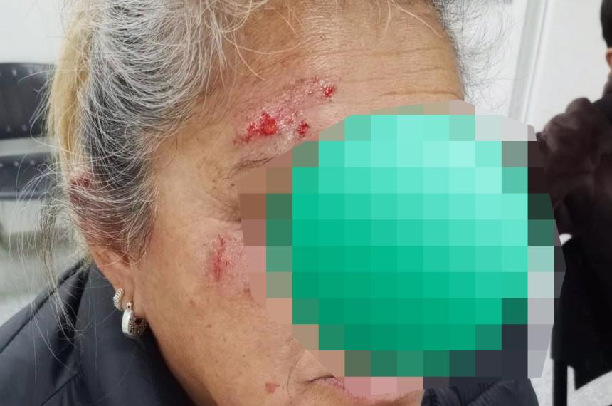 El hecho ocurrió en la calle Telén en 25 de Mayo