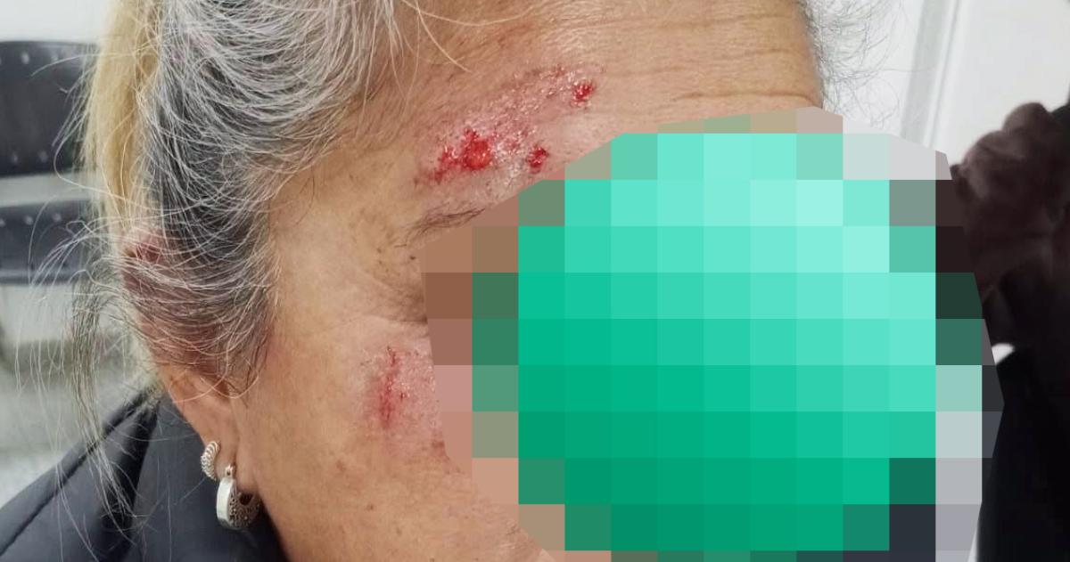 El hecho ocurrió en la calle Telén en 25 de Mayo