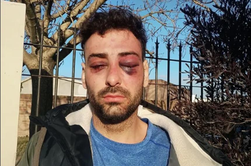 Lautaro Ruiz amplió la denuncia sobre el hecho ocurrido el pasado domingo