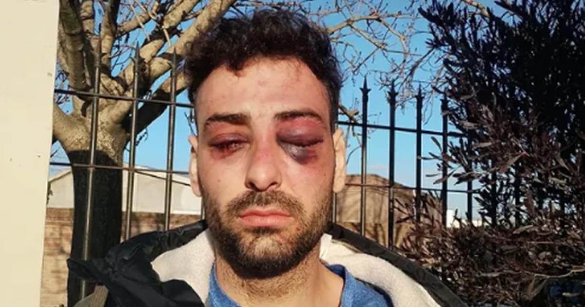 Lautaro Ruiz amplió la denuncia sobre el hecho ocurrido el pasado domingo