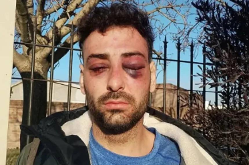 Un joven fue golpeado por la Policía en Santa Rosa