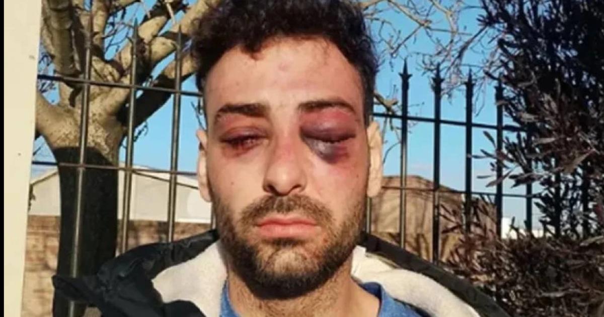 Un joven fue golpeado por la Policía en Santa Rosa