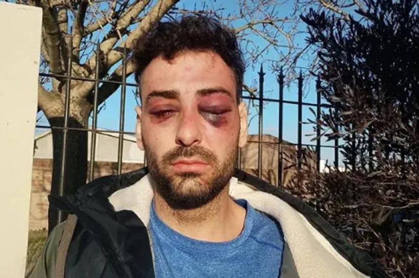 El lutier salvajemente golpeado por policías de la Seccional Primera