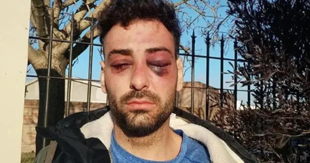 El lutier salvajemente golpeado por policías de la Seccional Primera
