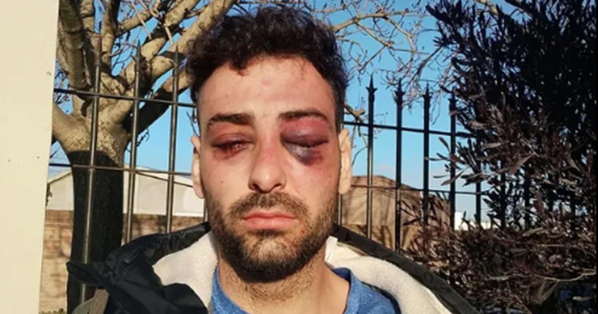 El joven fue agredido tras un incidente en la Terminal de Ómnibus de Santa Rosa