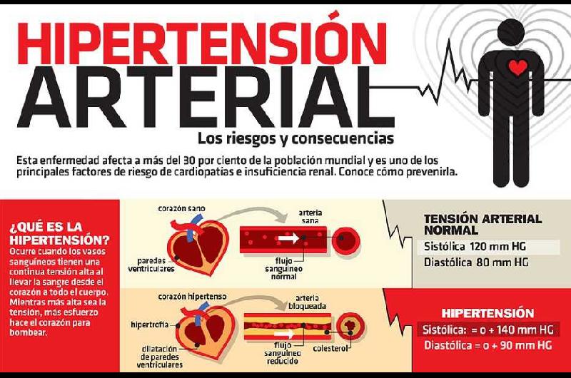 hipertension a