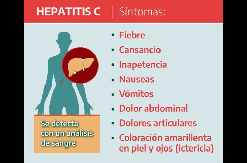 hepatitisc a