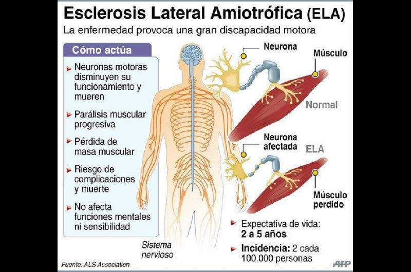 ELA a