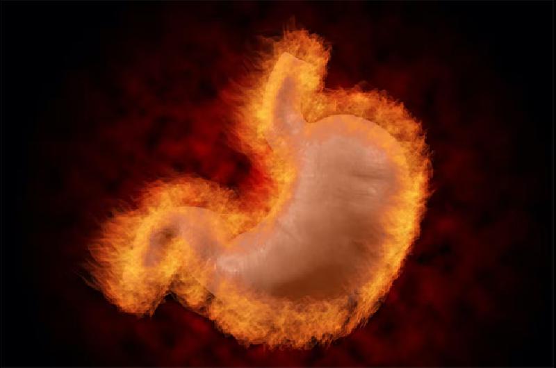 gastritis a