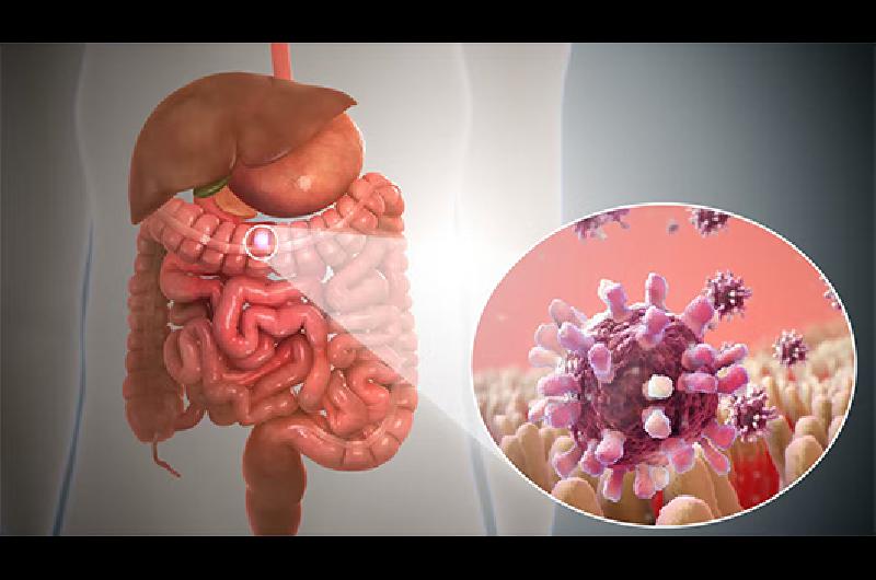 gastritis b