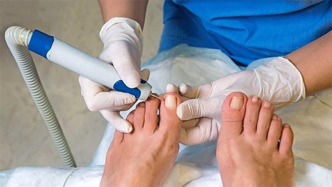 uñasencar a