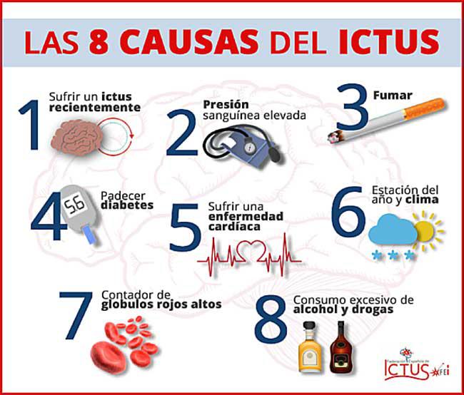 ictus a